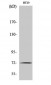 MMP-2 Polyclonal Antibody