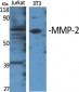 MMP-2 Polyclonal Antibody