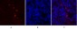 MMP-2 Polyclonal Antibody