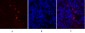 MMP-2 Polyclonal Antibody