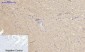MMP-2 Polyclonal Antibody