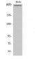 mTOR Polyclonal Antibody