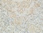 Mucin 16 Polyclonal Antibody