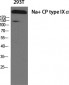 Na+ CP type IXα Polyclonal Antibody