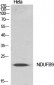 NDUFB9 Polyclonal Antibody