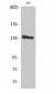 Neu Polyclonal Antibody