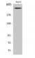 Neurofibromin Polyclonal Antibody