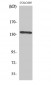 NFATc4 Polyclonal Antibody