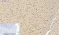 NFκB-p105/p50 Polyclonal Antibody