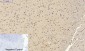 NFκB-p105/p50 Polyclonal Antibody