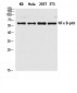 NFκB-p65 Polyclonal Antibody