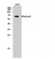 NFκB-p65 Polyclonal Antibody