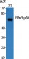 NFκB-p65 Polyclonal Antibody