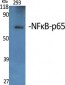 NFκB-p65 Polyclonal Antibody