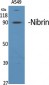 Nibrin Polyclonal Antibody