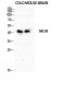 NK-1R Polyclonal Antibody