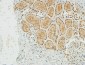 NM23-H1 Polyclonal Antibody