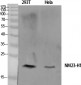 NM23-H1 Polyclonal Antibody