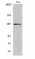 NOS2 Polyclonal Antibody