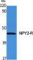 NPY2-R Polyclonal Antibody