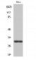 NQO1 Polyclonal Antibody