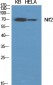 Nrf2 Polyclonal Antibody