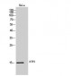 NTF2 Polyclonal Antibody