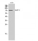 OATP-C Polyclonal Antibody