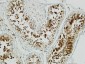 Op18 Polyclonal Antibody