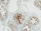 Op18 Polyclonal Antibody