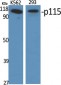 p115 Polyclonal Antibody