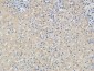 p15 Polyclonal Antibody