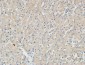 p15 Polyclonal Antibody