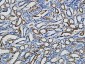 p15 Polyclonal Antibody