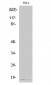 p16 Polyclonal Antibody