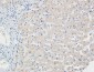 p21 Polyclonal Antibody