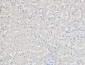 p21 Polyclonal Antibody