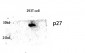p27 Polyclonal Antibody