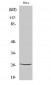 p27 Polyclonal Antibody