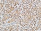 p38 Polyclonal Antibody