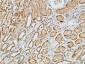 p38 Polyclonal Antibody