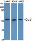 p53 Polyclonal Antibody