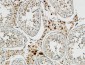 p53 Polyclonal Antibody