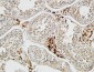 p53 Polyclonal Antibody