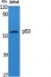 p53 Polyclonal Antibody