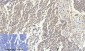 p53 Polyclonal Antibody