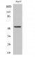 p53 Polyclonal Antibody