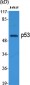 p53 Polyclonal Antibody