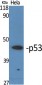 p53 Polyclonal Antibody