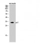 p57 Polyclonal Antibody